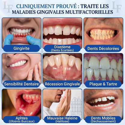 🦷⚡Solaroza® Gel Réparateur Parodontal – Régénération des Gencives