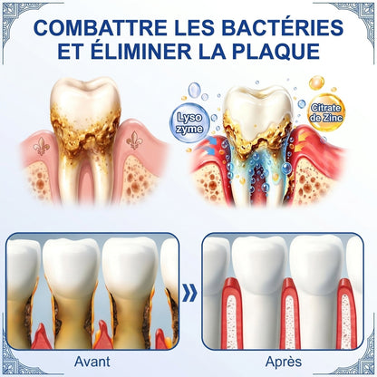 🦷⚡Solaroza® Gel Réparateur Parodontal – Régénération des Gencives