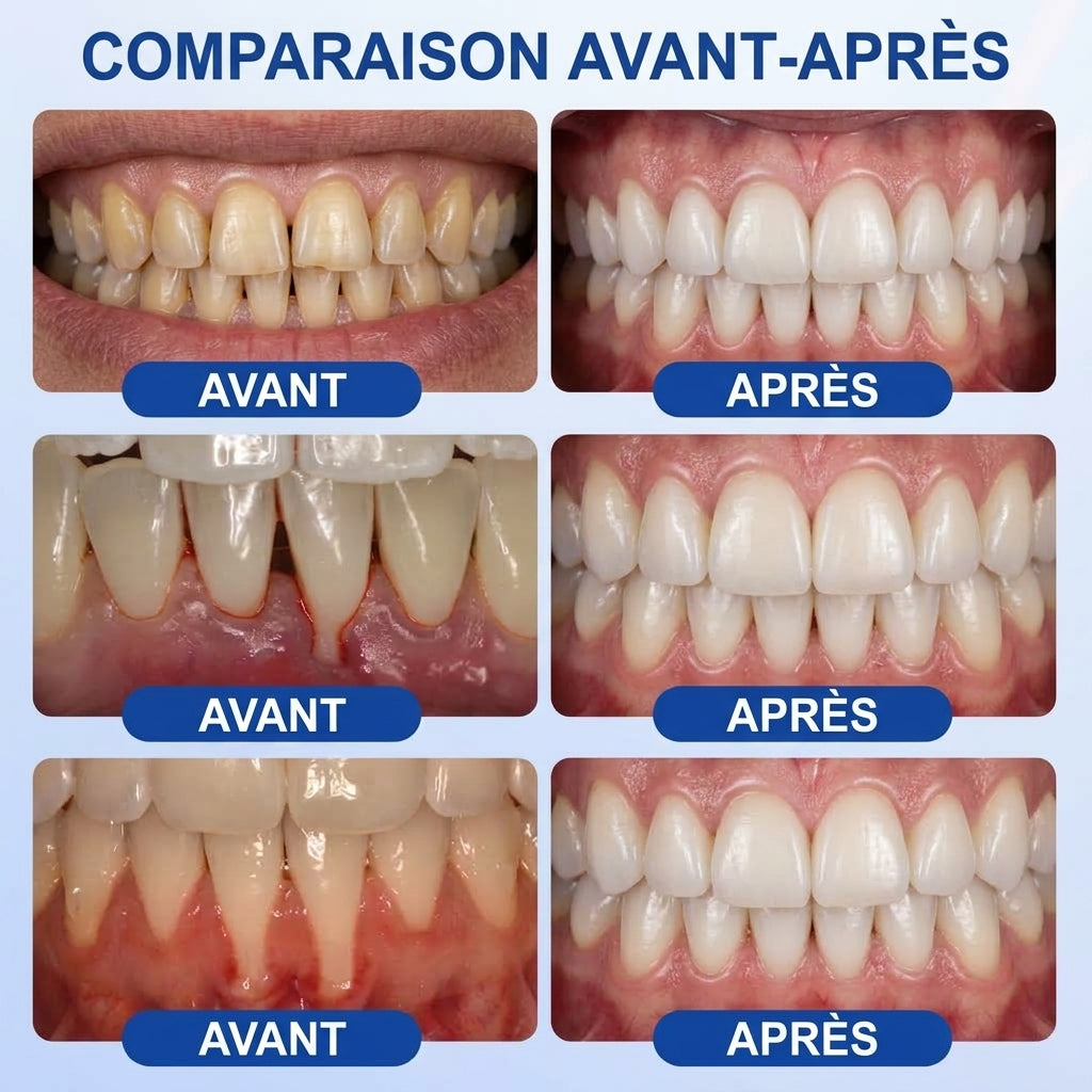 🦷⚡Solaroza® Gel Réparateur Parodontal – Régénération des Gencives