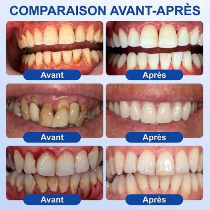 🦷⚡Solaroza® Gel Réparateur Parodontal – Régénération des Gencives