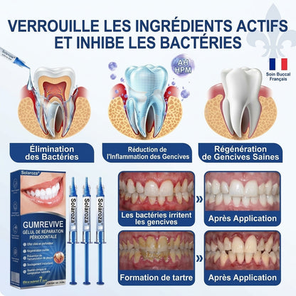 🦷⚡Solaroza® Gel Réparateur Parodontal – Régénération des Gencives